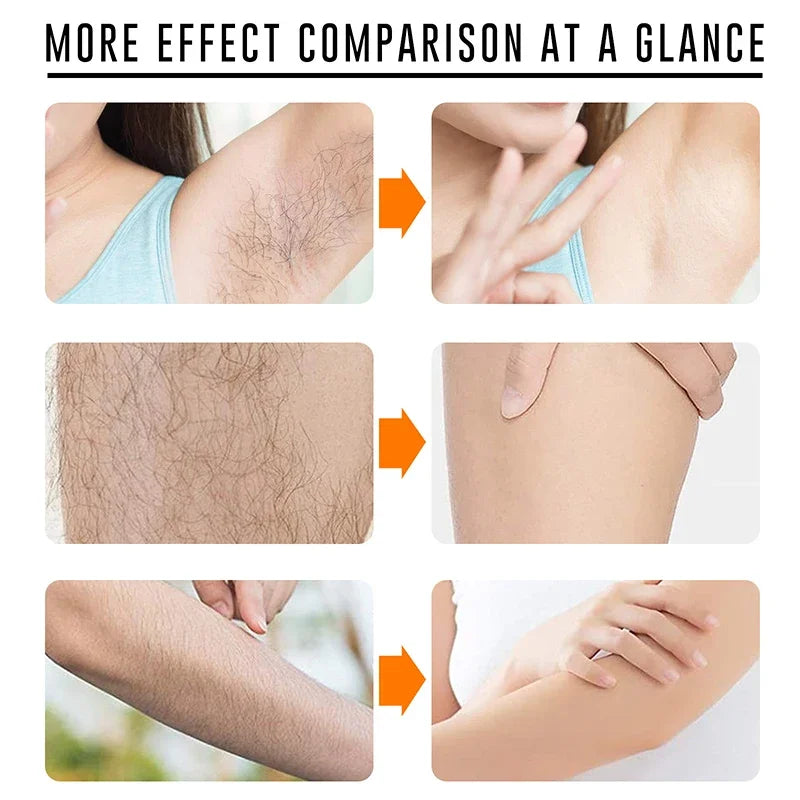 NordicGlow™ – The Ultimate Permanent Hair Removal Spray