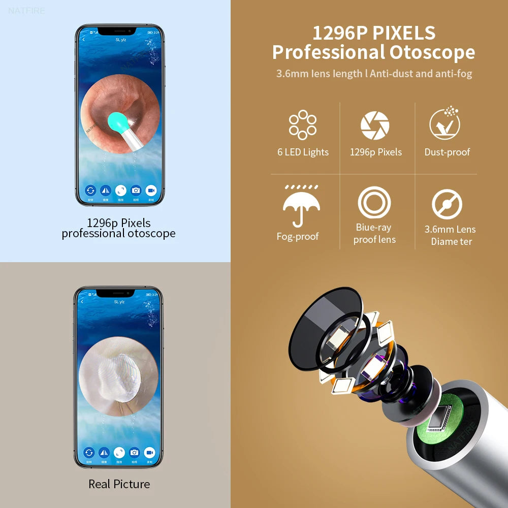 Hygge NE7 with EarScope™ - Wireless Otoscope