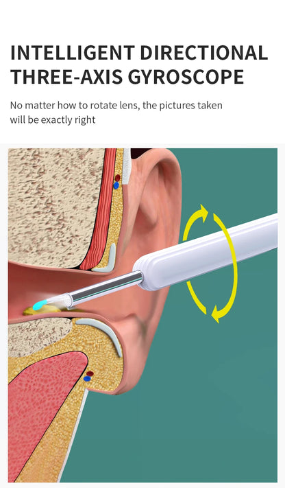 Hygge NE7 with EarScope™ - Wireless Otoscope