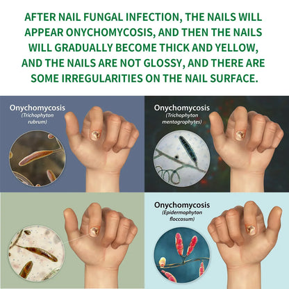 FungiFree™ by Familx: The Scandinavian Solution to Healthier Nails 🌿✨