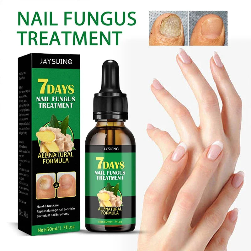 FungiFree™ by Familx: The Scandinavian Solution to Healthier Nails 🌿✨