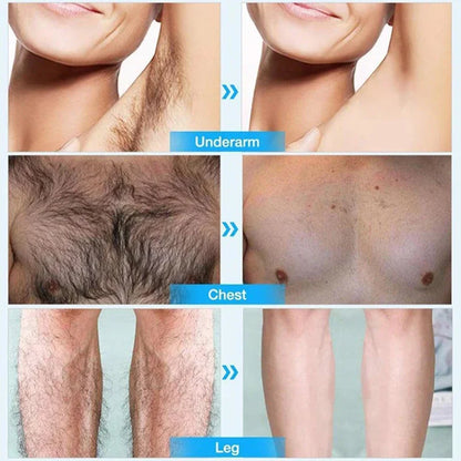 NordicGlow™ – The Ultimate Permanent Hair Removal Spray